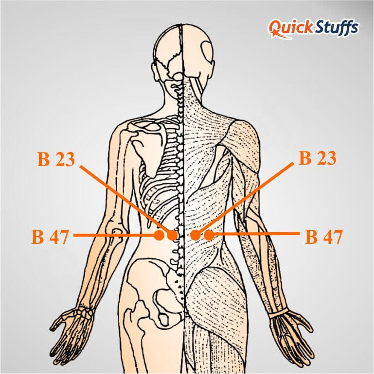 acupuncture points for sciatica, acupuncture points for sciatica pain relief, sciatica acupuncture points, acupuncture points for sciatica treatment